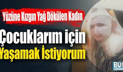 Yüzüne Kızgın Yağ Dökülen Kadın; Çocuklarım için Yaşamak İstiyorum!